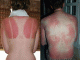 UV v�d�ruha
